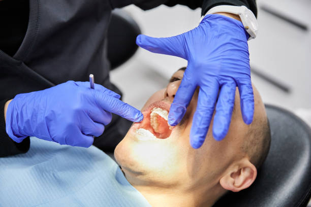 Best Emergency Tooth Extraction in Mayo, FL