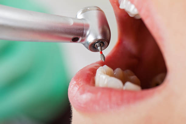 Best Urgent Care for Lost Fillings or Crowns in Mayo, FL